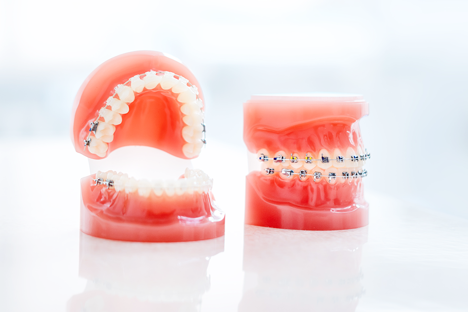 美しい見た目と機能的なかみ合わせで健康なお口に