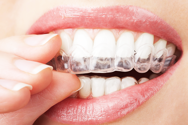 治療完了・保定